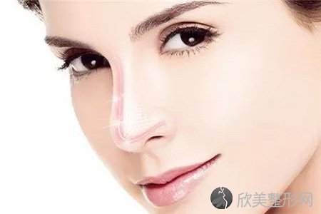 北京硅胶隆鼻费用是多少