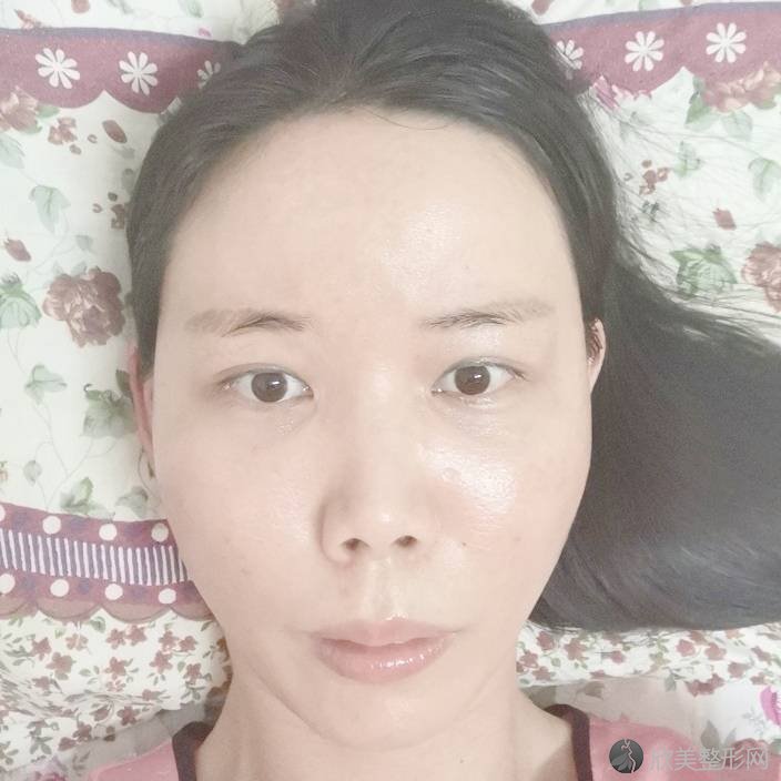 重庆晶肤医疗美容医院赖致祥做激光美白怎么样？附医生简介-激光美白案例及