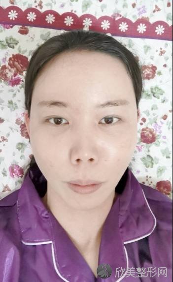 重庆晶肤医疗美容医院赖致祥做激光美白怎么样？附医生简介-激光美白案例及