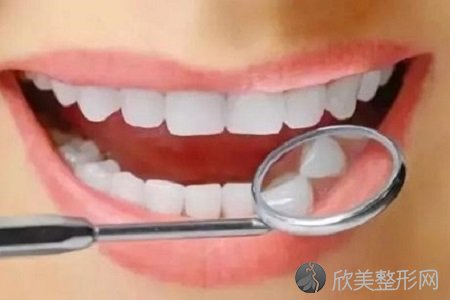 成年人是否可以矫正牙齿？