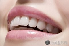 矫正牙齿多少钱