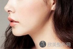 玻尿酸隆下巴多少钱?
