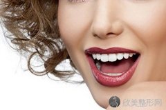 牙齿整形要多少钱