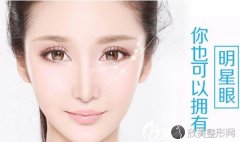 杭州做埋线双眼皮手术需要多少钱?