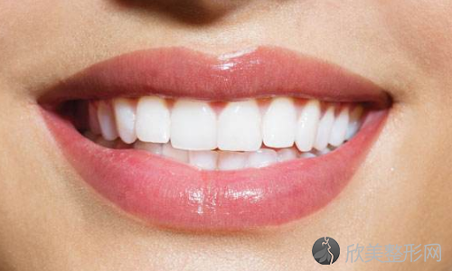 成人能牙齿矫正吗