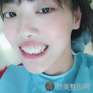 黔东南十大烤瓷牙医院10强医院口碑特色各不同~价格收费合理！