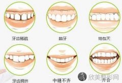 牙科矫正牙齿