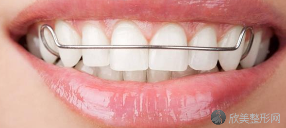 牙齿矫正术有什么特点