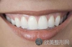 牙龈出血用什么牙膏好