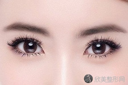 上海做双眼皮大概需要多少钱