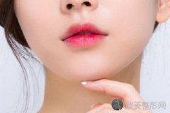 玻尿酸丰下巴效果好吗