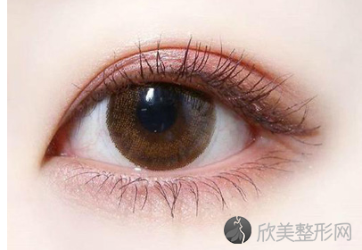 北京三点式双眼皮手术价格是多少