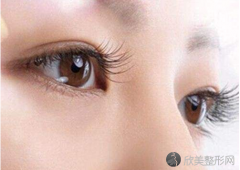 郑州埋线双眼皮一般需要多少钱?