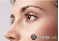 北京双眼皮的费用一般是多少呢？