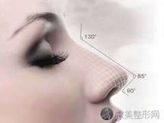 昆明假体隆鼻手术需要多少钱?