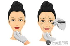 成都打水光针一般多少钱