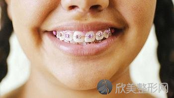 上海儿童牙齿排列不齐做矫正治疗的费用是多少