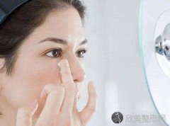 知道除皱的价格是多少吗