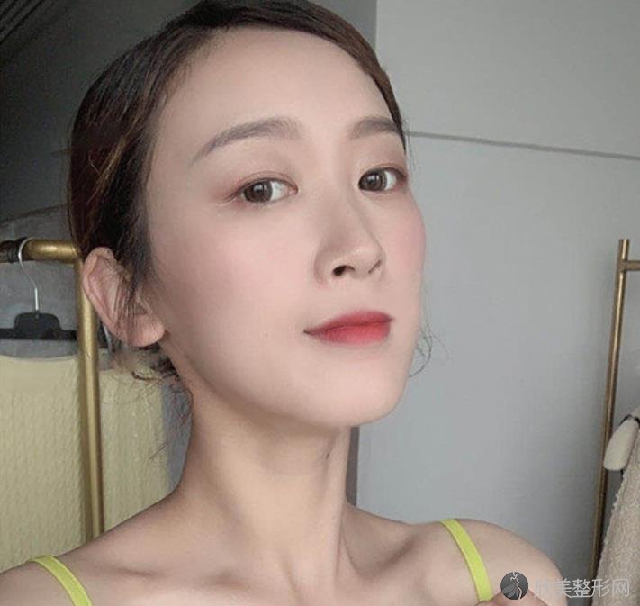 秦皇岛较好医院面部吸脂究竟怎么样？内附2021较新整形价格表分享