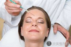 自体脂肪去法令纹能保持多久？