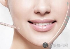 杭州水光针多久才能看到理想效果
