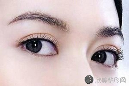 重庆祛眼袋手术一般需要多少钱