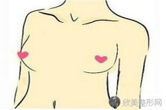 重庆做假体隆胸一般材料有哪些