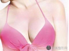 北京自体脂肪隆胸的费用多少