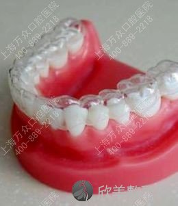 上海做牙齿隐形矫正透明牙套要多少钱