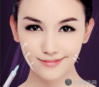 水光针间隔多久打一次比较好