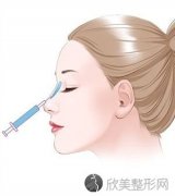 成都玻尿酸隆鼻价格是多少