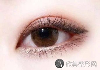 上海做双眼皮价格一般是多少？