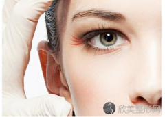 北京做膨体隆鼻手术效果能维持吗