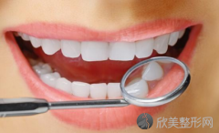 虎牙有哪几种矫正方法