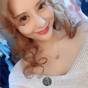 杭州千晴医疗美容诊所王婧做玻尿酸丰卧蚕怎么样？附医生简介-玻尿酸丰卧蚕