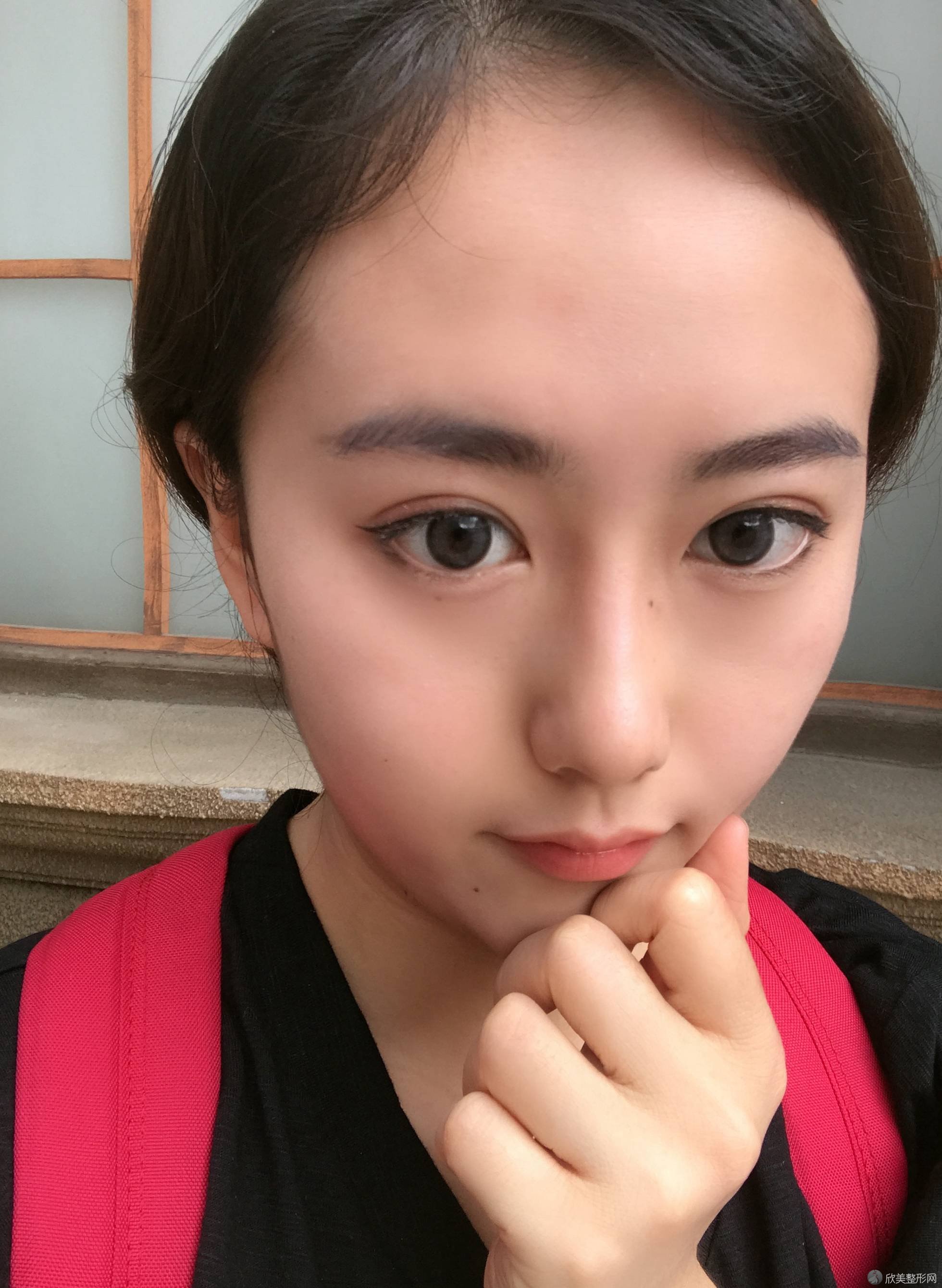 杭州秦良忠医学美容诊所秦良忠做玻尿酸卧蚕怎么样？附医生简介-玻尿酸卧蚕