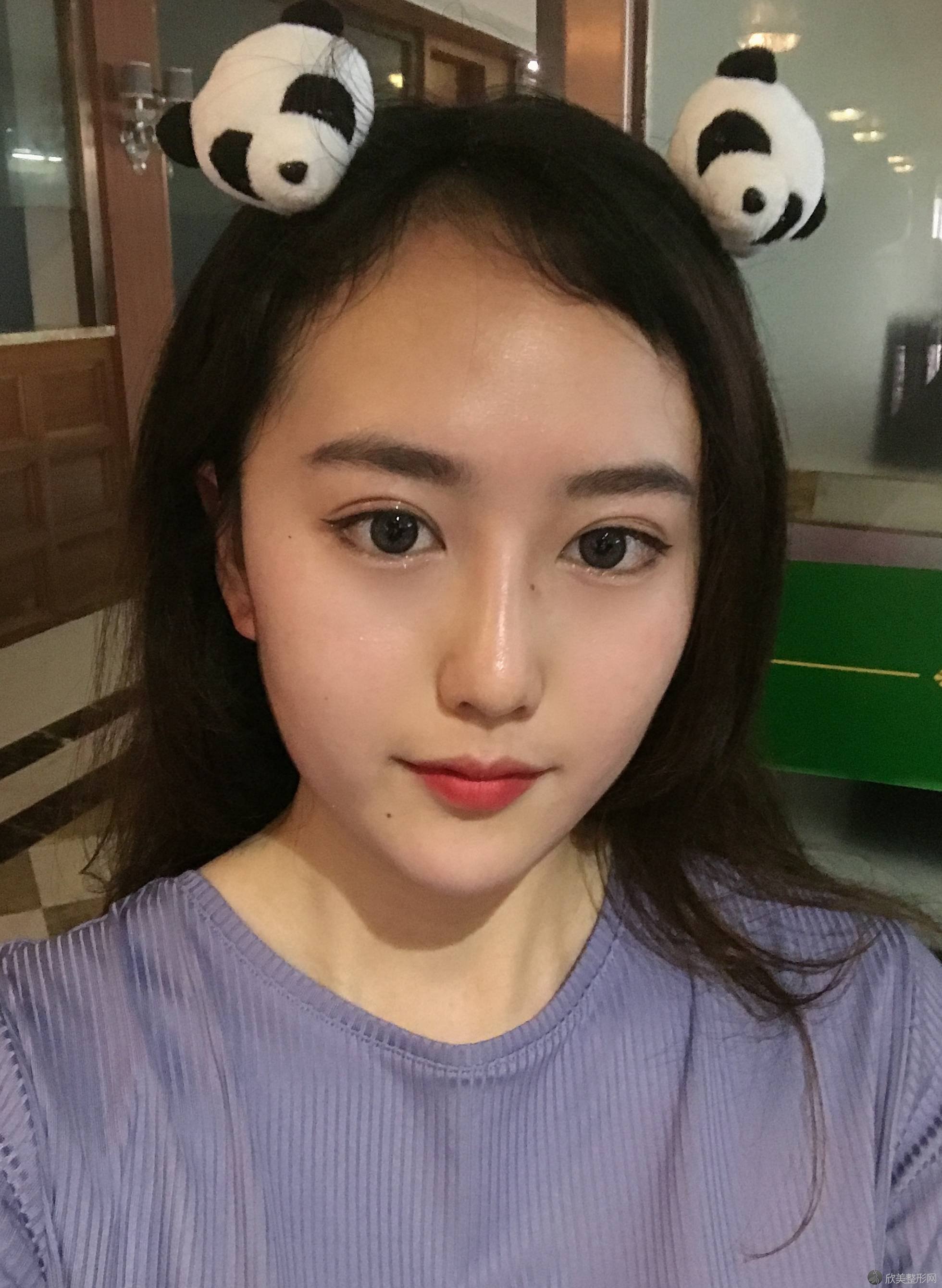 杭州秦良忠医学美容诊所秦良忠做玻尿酸卧蚕怎么样？附医生简介-玻尿酸卧蚕