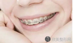 戴牙套哪个步骤较疼