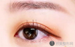 昆明现在做双眼皮手术需要多少钱
