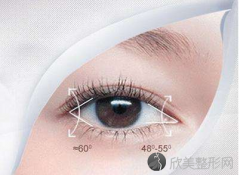 广州眼睛双眼皮修复术后怎样护理