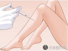 杭州打瘦腿针能维持多久的效果呢