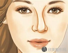 贵阳做歪鼻矫正大概要多少钱呢