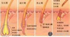 厦门激光脱腿毛美肤效果好吗