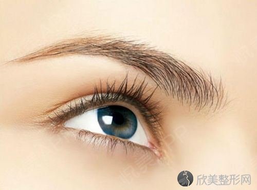 南京双眼皮修复是怎么回事呢