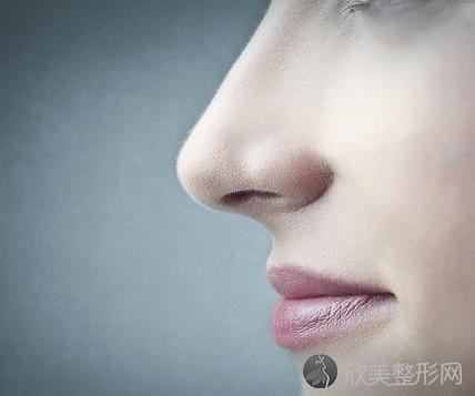 杭州线雕隆鼻和玻尿酸隆鼻哪个好