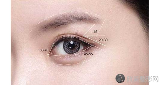 深圳全切双眼皮手术恢复时间是多久