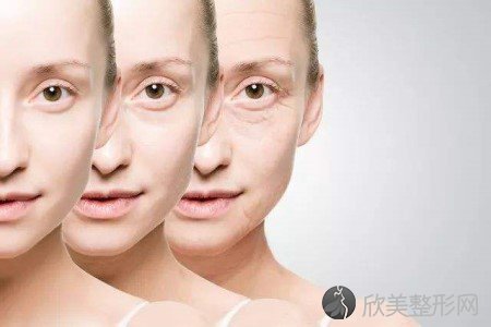 皮肤衰老有哪些症状,方法有哪些呢?