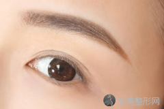北京整形医院的医师告诉你洗眉要多少钱？