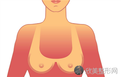 上海做假体隆胸术后怎么样比较快速的恢复好