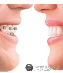 揭秘：上海比较好的龅牙矫正医院是哪里